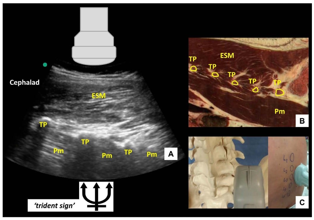 UGLC Figure 4