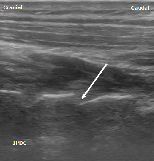 Ultrasound Sonoanatomy and Associated Interventional Procedures 