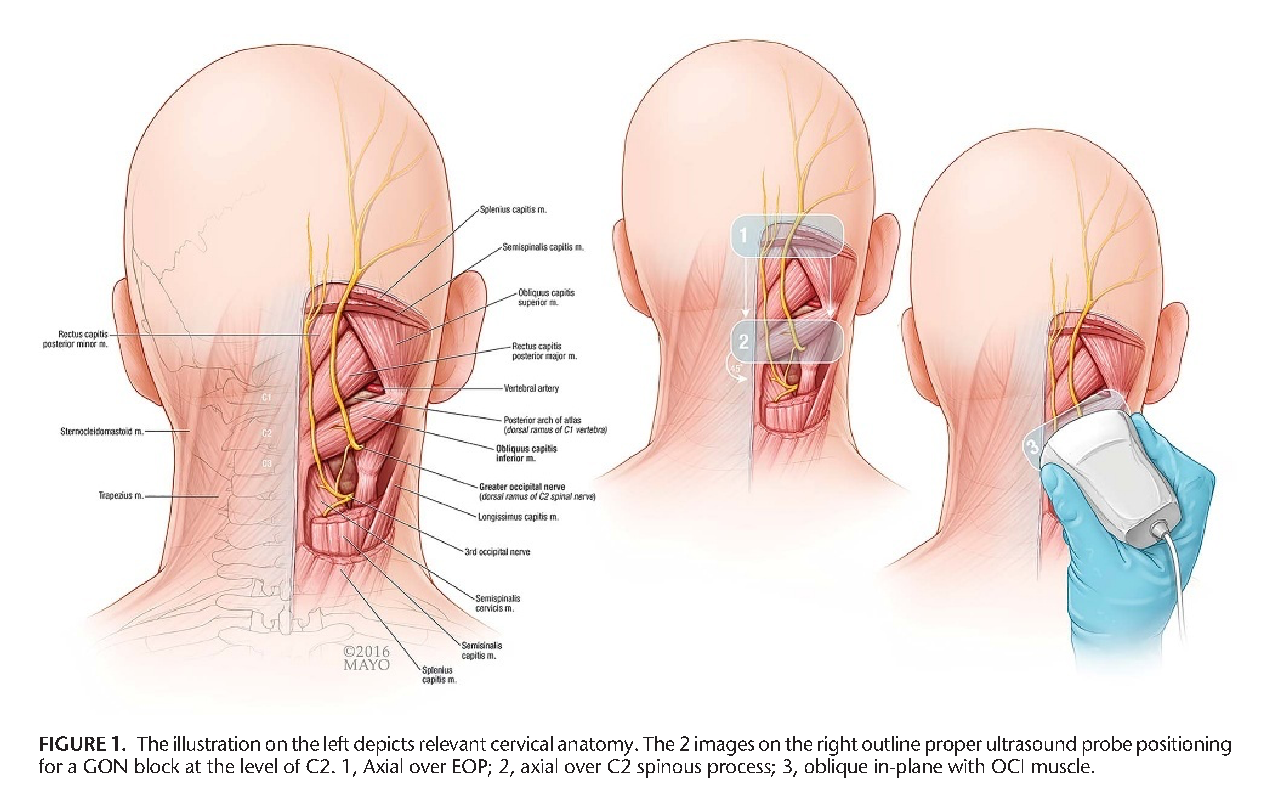 greater occipital nerve and artery