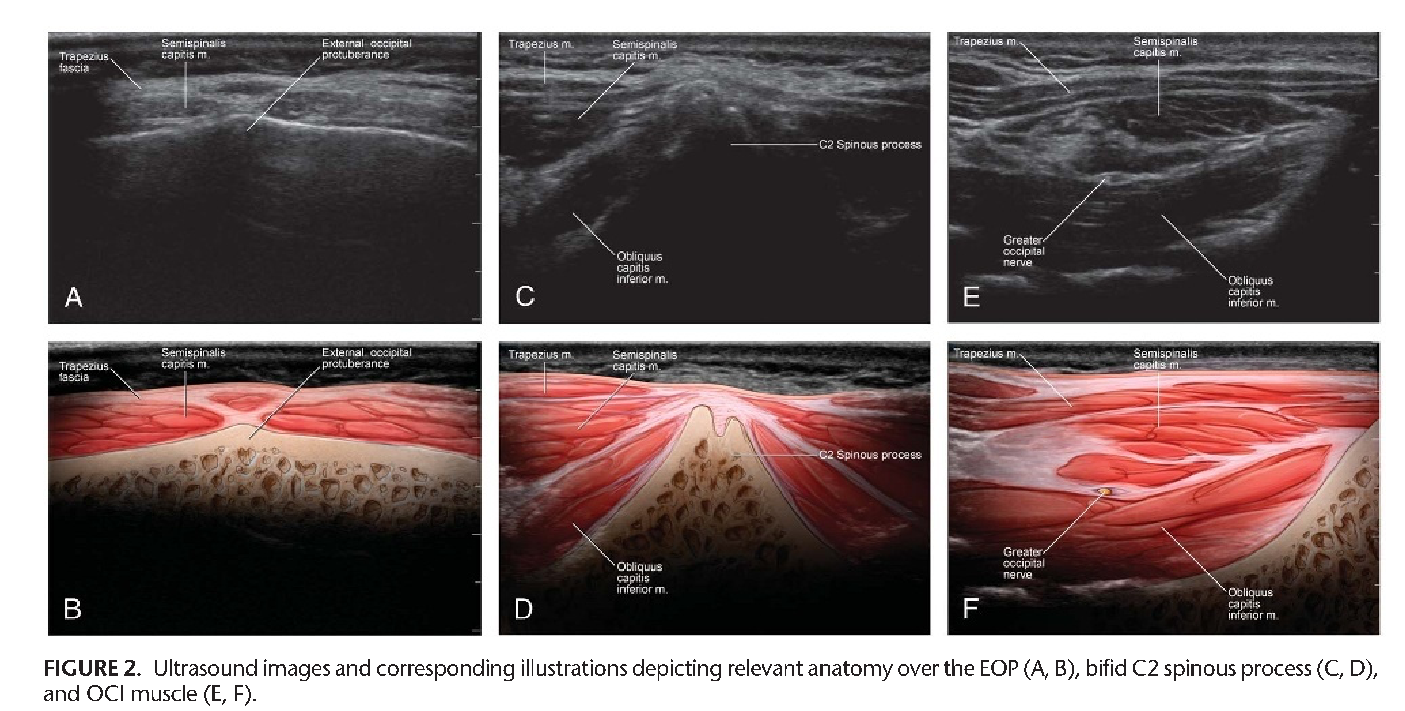 Anatomy over the EOP