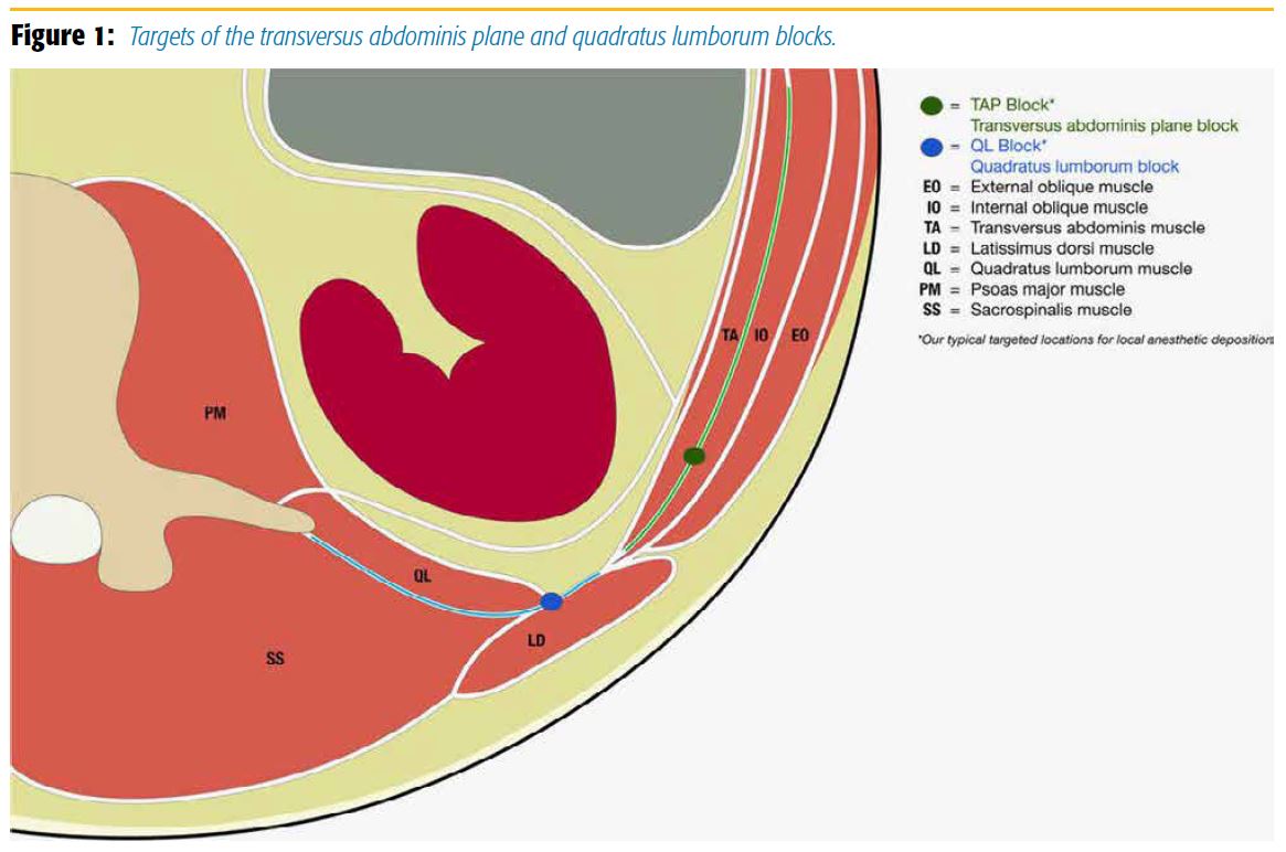 Targets of the transversus abdominis plane and quadratus lumborum blocks