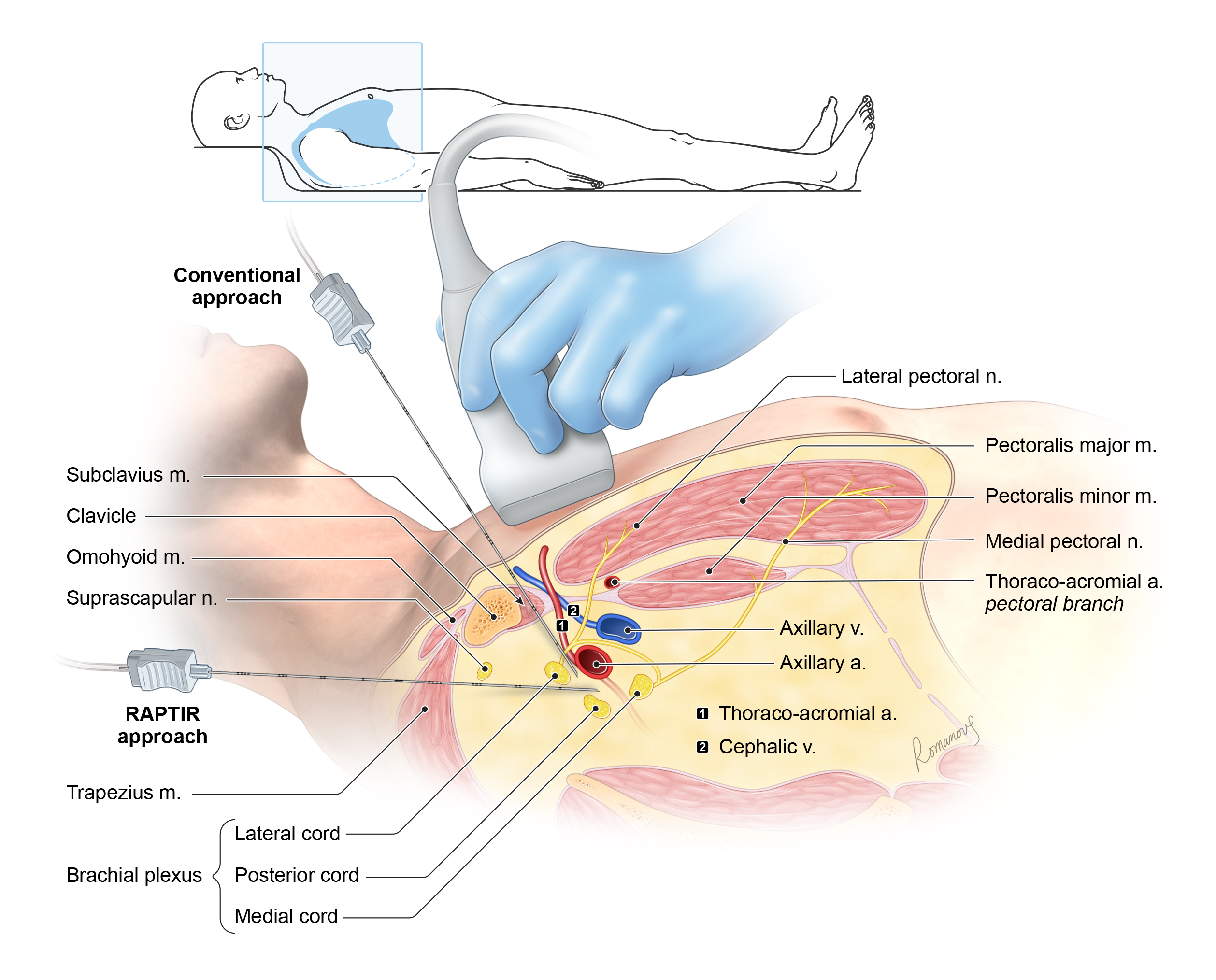 RAPTIR Block 5MS (2021) - Core Ultrasound